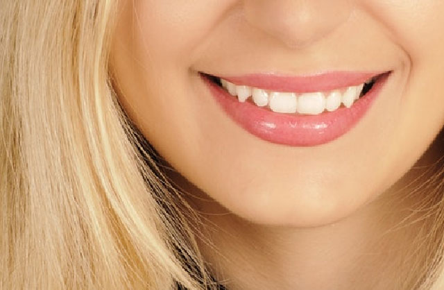 Woman’s smile showing her teeth