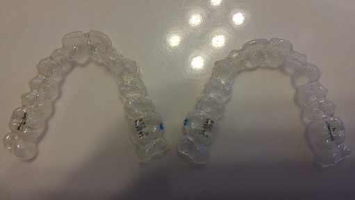 what-is-invisalign